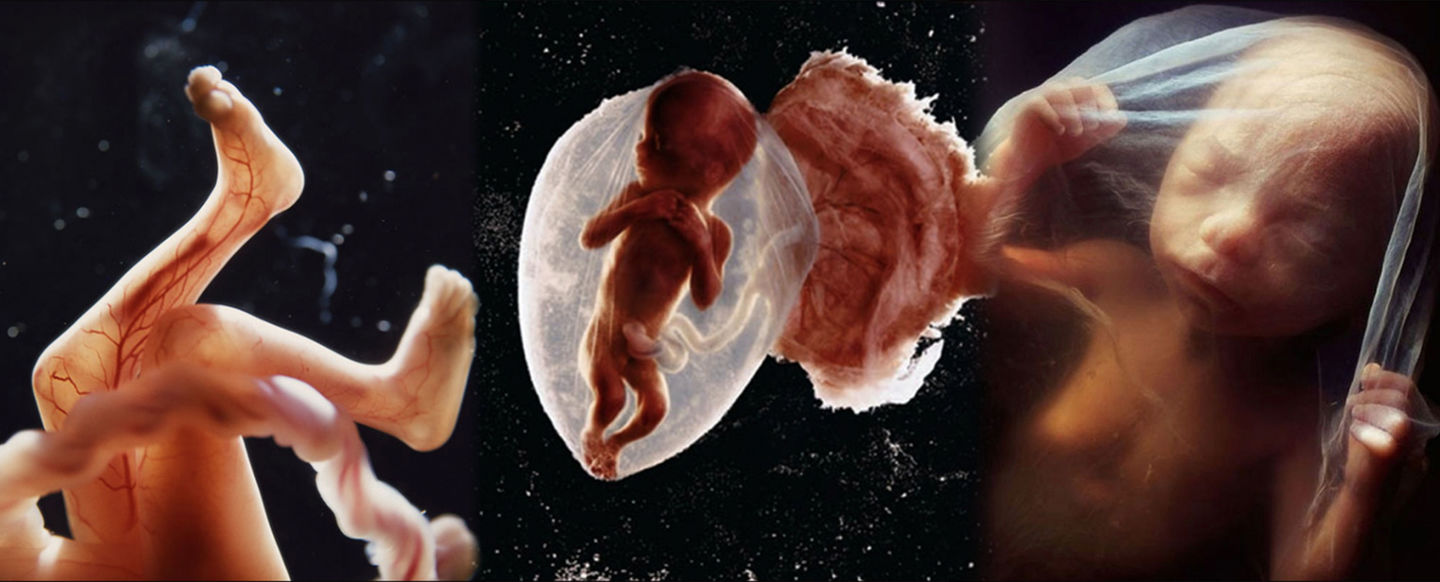 Como foram feitas as primeiras fotos de bebês ainda no útero da mãe